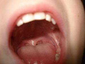 舌2