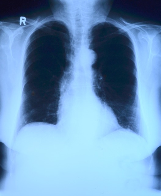 肺５