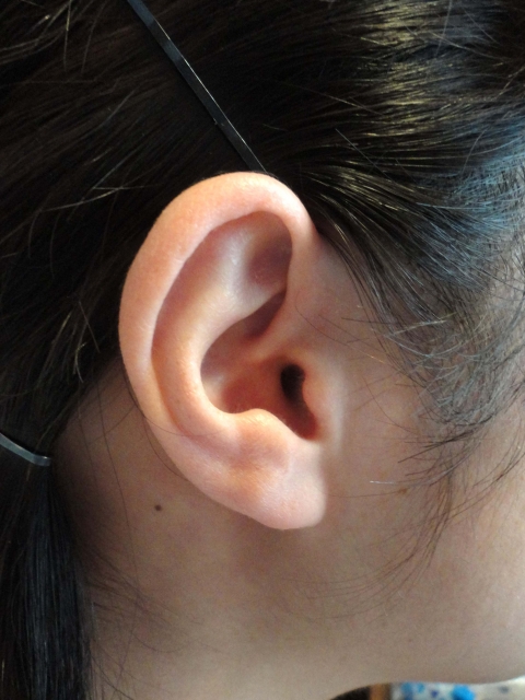 耳 の 後ろ 膿
