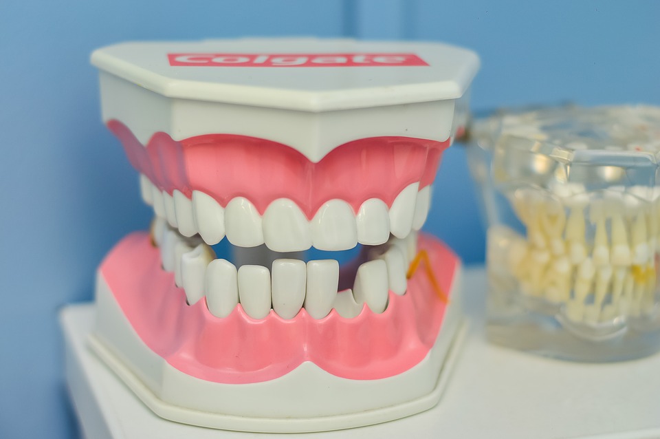歯 が 欠け た 時 の 対処 法