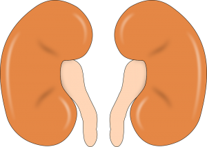 腎結石