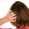 頭皮湿疹が現れる原因とは？髪の洗いすぎに要注意！
