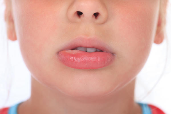 唇の腫れの６つの原因とは しびれを感じる場合は病気 対処法も紹介 Hapila ハピラ