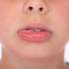 唇の腫れの６つの原因とは？しびれを感じる場合は病気？対処法も紹介！