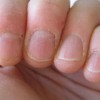 爪の甘皮の処理方法とは？やり方を知って簡単に処理しよう！