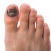 足の爪が黒い７つの原因とは！斑点が現れている人は要注意！
