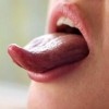 舌が黒い原因は？口臭や倦怠感に要注意！