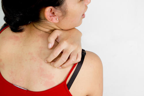 背中がかゆい原因は 病気の可能性について 乾燥肌が原因の対策法は Hapila ハピラ