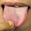 舌が白い原因を紹介！治す方法はあるの？