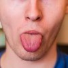 舌のしびれの原因は？痛みを感じるのは病気なの？