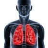 肺に影がある時は病気なの？レントゲンで分かる事って？