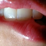 唇が切れる６つの原因とは？端や真ん中が切れて痛い時の対処方法！