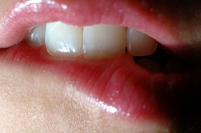 唇が切れる6つの原因とは？端や真ん中が切れて痛い時の対処方法！ | Hapila [ハピラ]