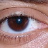 目頭が腫れる４つの病気を紹介！痛みやかゆみが症状として現れる場合は注意！