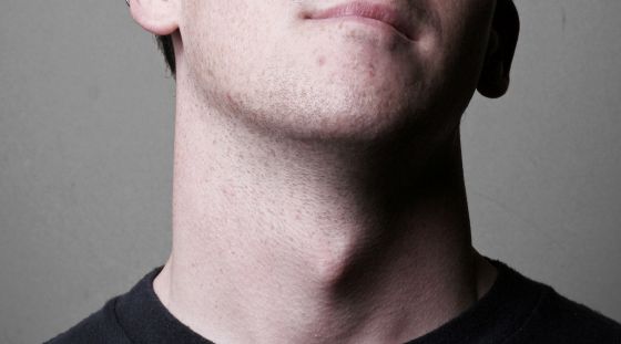 喉仏が痛い原因とは？病気の可能性と治療法について！ | Hapila [ハピラ]