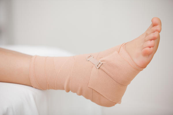 足首の手術後の神経損傷の原因