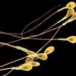 精子が黄色っぽい原因は？病気の可能性や検査方法を紹介！