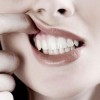 歯茎が腫れる原因は？考えられる病気や対処方法を紹介！