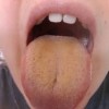 舌が黄色い原因は？症状や病気の可能性について紹介！