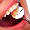 歯肉癌について！症状や原因、治療法と予防法を紹介！