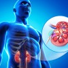 腎臓の石灰化とは？治療法や症状、原因を知って予防しよう！
