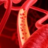 血管が細いのは危険？原因や太くする３つの方法を紹介！
