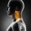 頸椎の痛みの原因は何？病気の可能性と治療方法について！