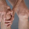 変形性膝関節症とは？原因・症状・治療方法を理解しよう！