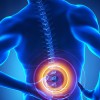 腰部脊柱管狭窄症の治療には手術が必要？症状・原因・予防法を理解しよう！