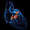 心臓弁膜症の手術について！症状・原因・治療法を知ろう！