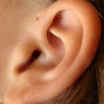 耳瘻孔の手術の内容とは？症状・原因・治療法・発生する確率について知ろう！