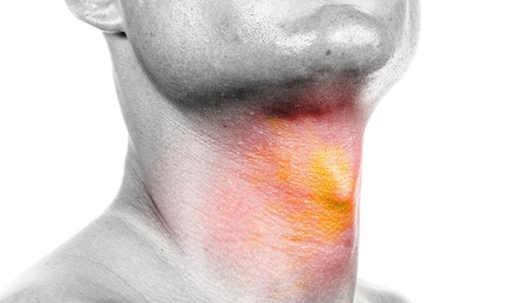 声帯ポリープは手術じゃなくても治る？投薬治療での副作用を知ろう！症状や原因は？ | Hapila [ハピラ]