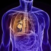 肺腫瘍は早期発見が大事！治療法や症状、原因を紹介！良性でも注意が必要？