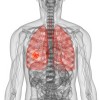 塵肺が発生する仕組みを知ろう！症状や原因となる粉塵を紹介！治療法と予防法は？