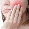 歯髄炎は放置すると危険？症状や原因、治療法を紹介！レントゲンで検査は可能？