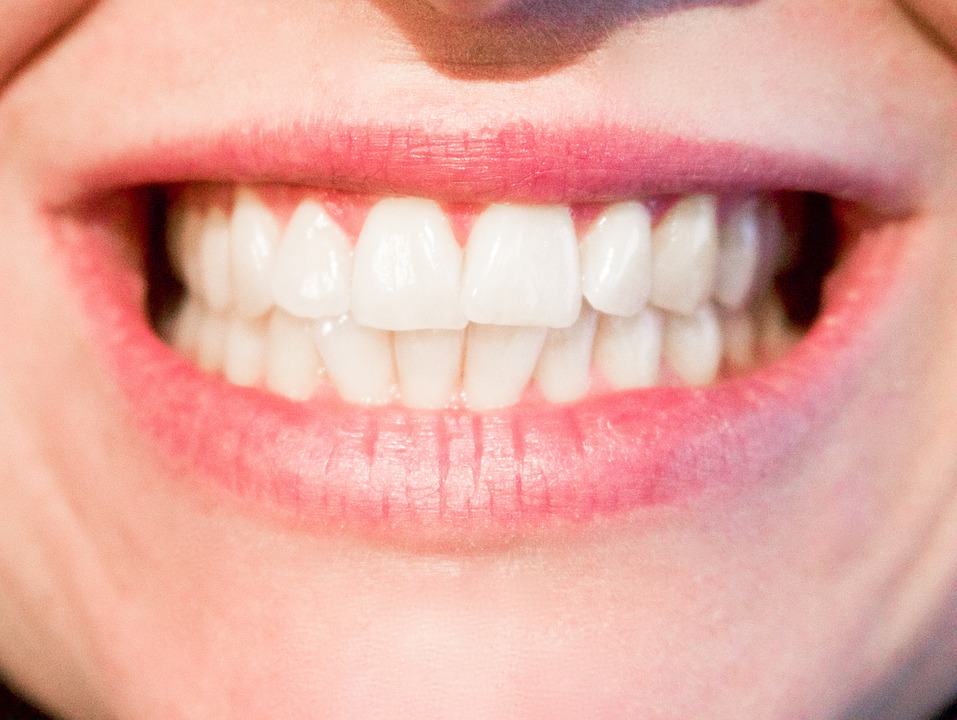 teeth-1652976_960_720%e7%99%bd%e3%81%84%e6%ad%af