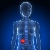 腎臓の腫瘍が良性なのはどんな場合？悪性の場合の症状や検査法、治療法を知ろう！