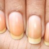 爪が変色するのは病気？色別に考えられる原因や症状、治療法を紹介！