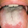 舌苔とは？原因や症状、対処法を知ろう！歯ブラシで舌を擦るのはダメなの？