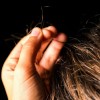抜毛症とは？症状や原因、関係のある病気を紹介！治療するにはどうする？