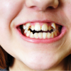 歯並びは遺伝する？原因と治療法、歯並びが悪いデメリットを紹介！
