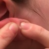耳たぶがかゆい原因は？病気の可能性と対処方法を知っておこう！